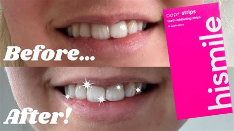 smile tsrip|happy smile strips.